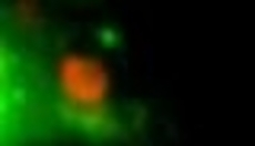 Entry thumbnail. Go to Video 1.2 MMP14-GFP trafficking from a late endosome to the cell surface (108-136 sec). with duration: 5 seconds